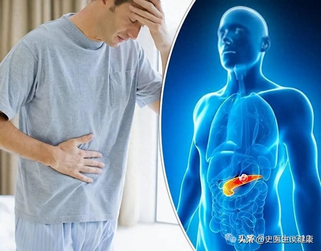 医生发现：容易得胰腺癌的人，一般都有这几个习惯，快看你有吗？