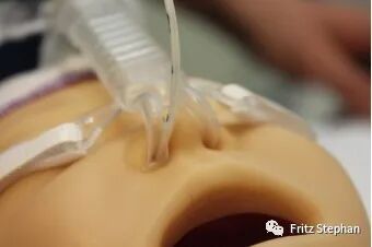 为什么CPAP换成双水平模式呼吸窘迫综合征早产儿的肺表面活性剂替换治疗_https://www.jmylbn.com_新闻资讯_第4张