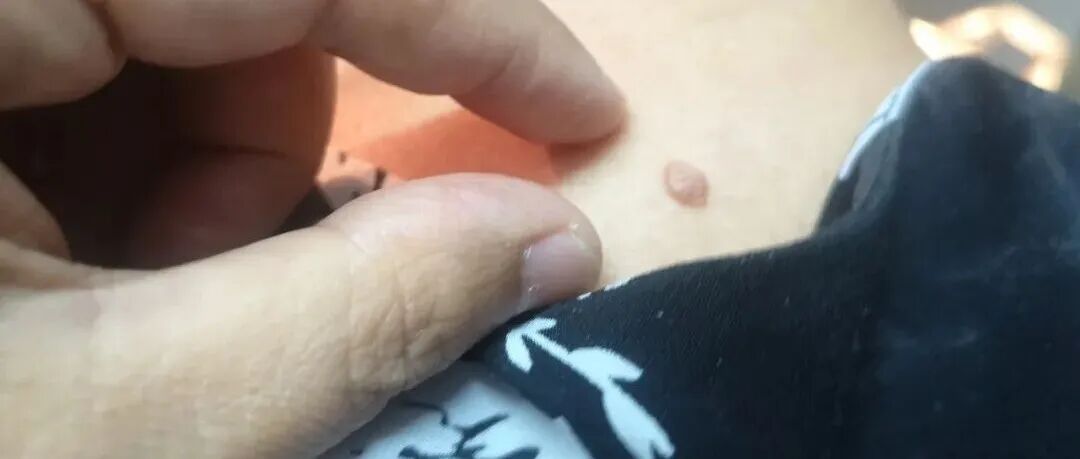 文章封面