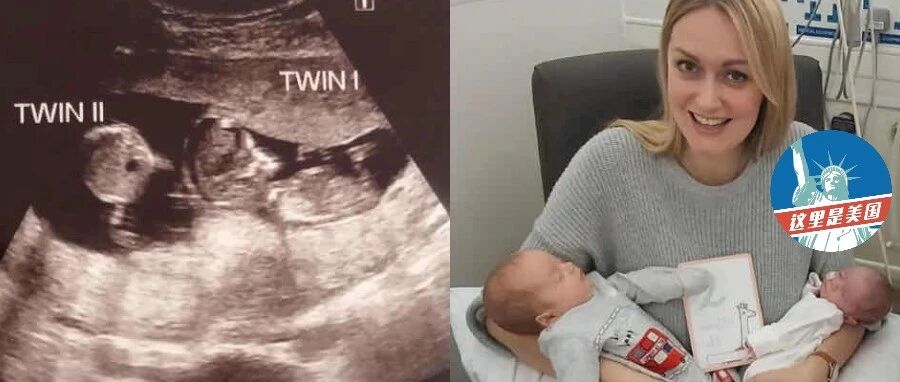 亲妈都吓坏了!兄妹俩“相差三周大”，还同一天出生?!