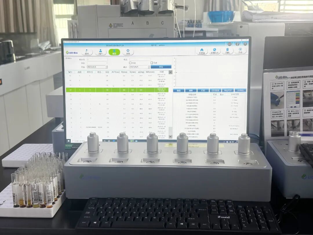 血凝仪哪些科室用检验科开展血栓弹力图试验检测凝血功能_https://www.jmylbn.com_新闻资讯_第2张