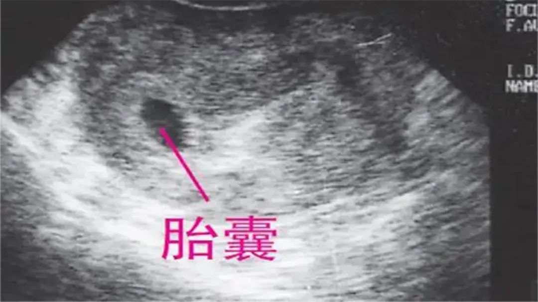 正规机构香港验血有哪些_香港验血正规的是哪几家_香港验血的正规机构有哪些