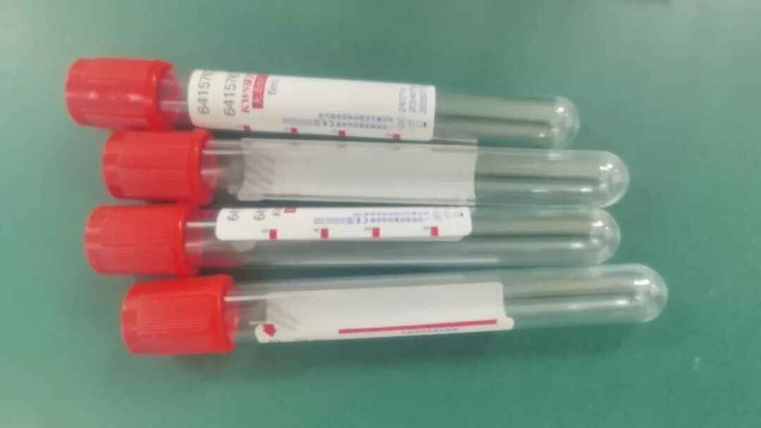 采血管颜色代表什么检验科里的“彩虹管”：不同颜色的采血管有啥讲究？_https://www.jmylbn.com_新闻资讯_第8张
