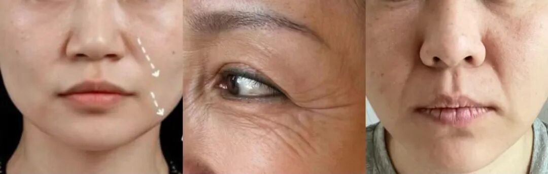 绽媄娅的产品怎么样哪有什么“断崖式衰老”，卷医美不如做好这件事_https://www.jmylbn.com_新闻资讯_第1张