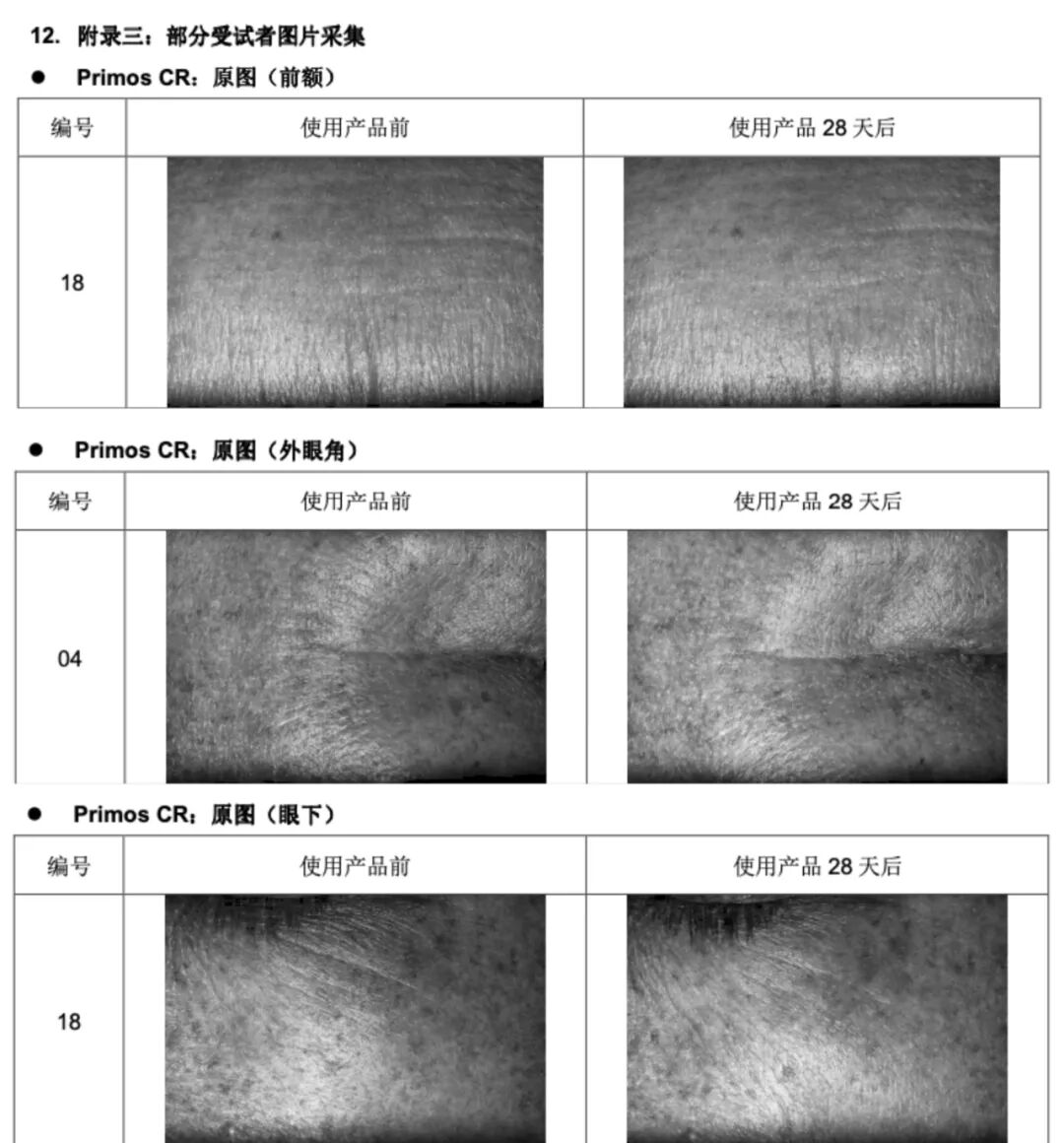 绽媄娅的产品怎么样哪有什么“断崖式衰老”，卷医美不如做好这件事_https://www.jmylbn.com_新闻资讯_第19张