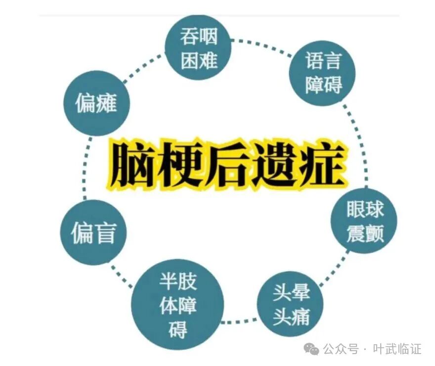 脑梗死后遗症千古名方