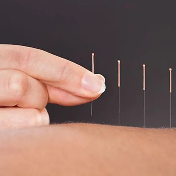 导什么针什么【中医知识】中医治病的六大疗法，你都知道吗？_https://www.jmylbn.com_新闻资讯_第5张