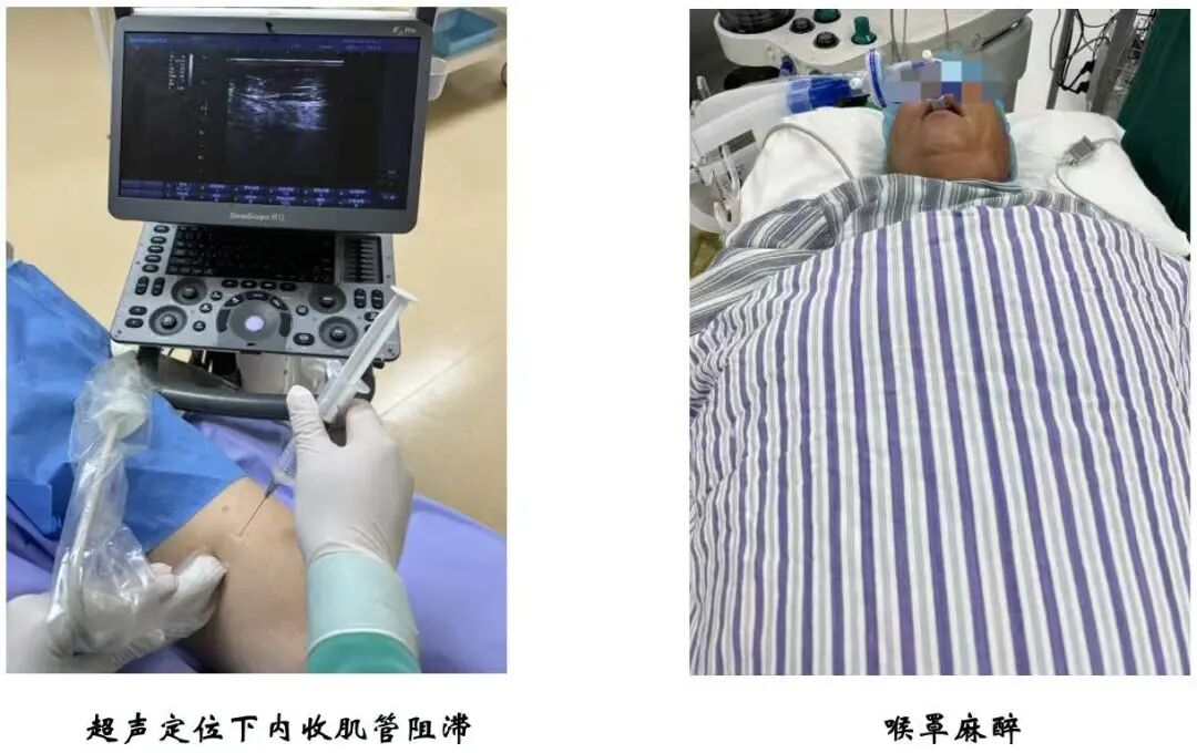 【滑动垫片单髁置换技术精讲系列】第一讲：麻醉、体位