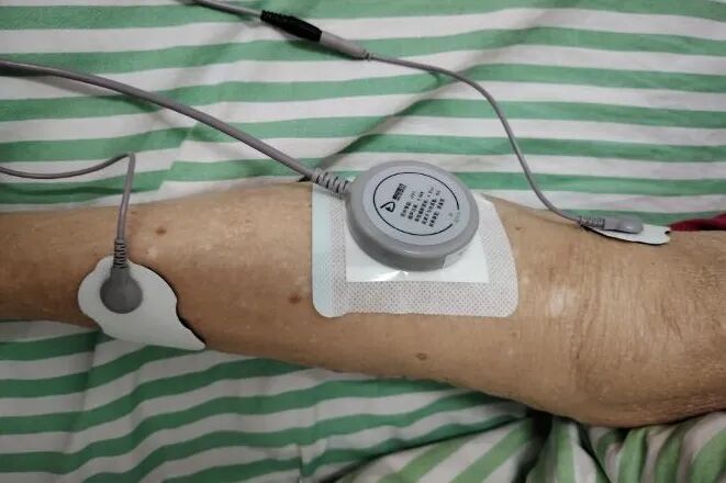 超声透药仪什么牌子好超声药物透入治疗骨科疼痛_https://www.jmylbn.com_新闻资讯_第3张