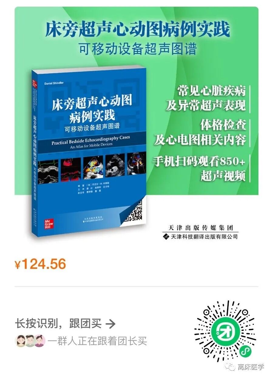 poc超声什么意思静脉瘀血的超声评估-上海聚慕医疗器械有限公司