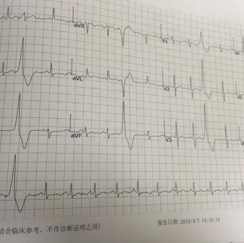 已经做了心电图，为什么医生还要让做心超？
