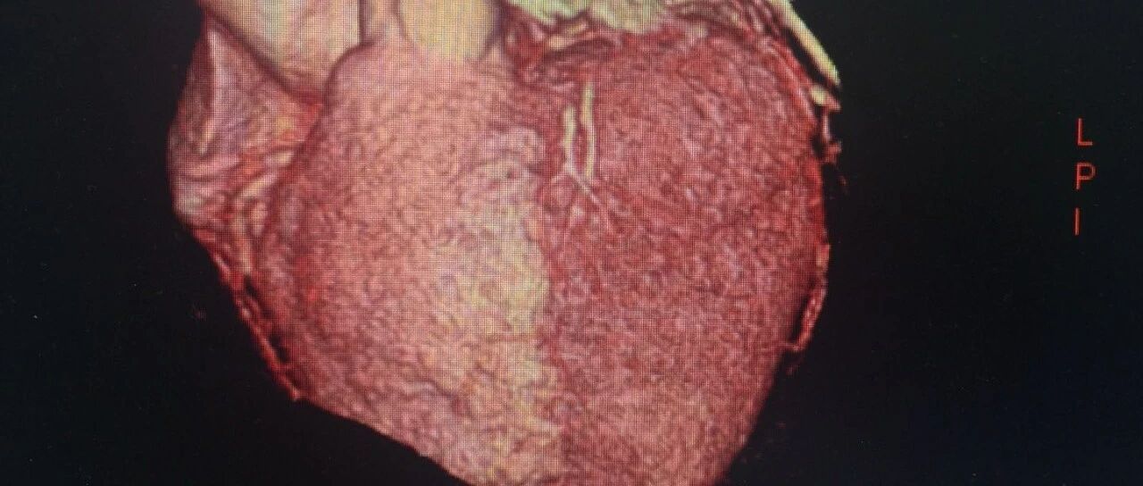 首次猪心移植---你需要知道的!