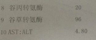 检查报告单中“转氨酶”偏高，意味着什么？
