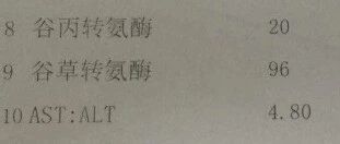 没有症状的肝病，怎么样才知道已经患病？