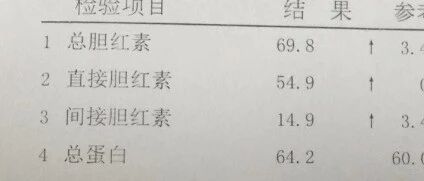 胆红素高一般会是什么病？