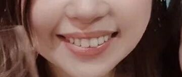 人体都有哪些孔洞？