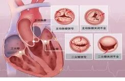 心脏彩超示意图