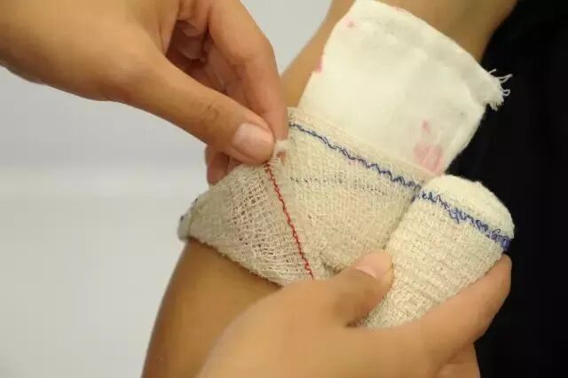 纱布绷带怎么用外伤处理中5种绷带包扎方法，速速get!_https://www.jmylbn.com_新闻资讯_第15张