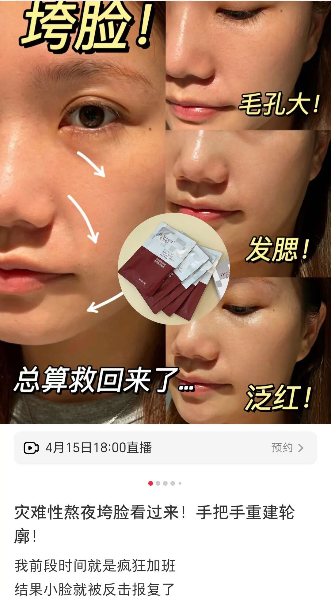 胶原美敷是什么「Dr.Sillmer生美博士白细胞玻尿酸熬夜胶原面膜」紧致抗皱温和修护_https://www.jmylbn.com_新闻资讯_第28张