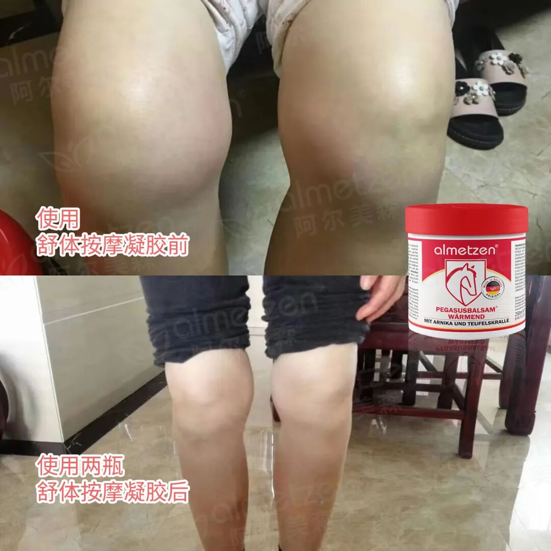 什么德国凝胶「德国阿尔美森舒体按摩凝胶」德国专业球员指定康复产品！凝胶自发热，5分钟缓解，欧盟品质安全温和_https://www.jmylbn.com_新闻资讯_第9张