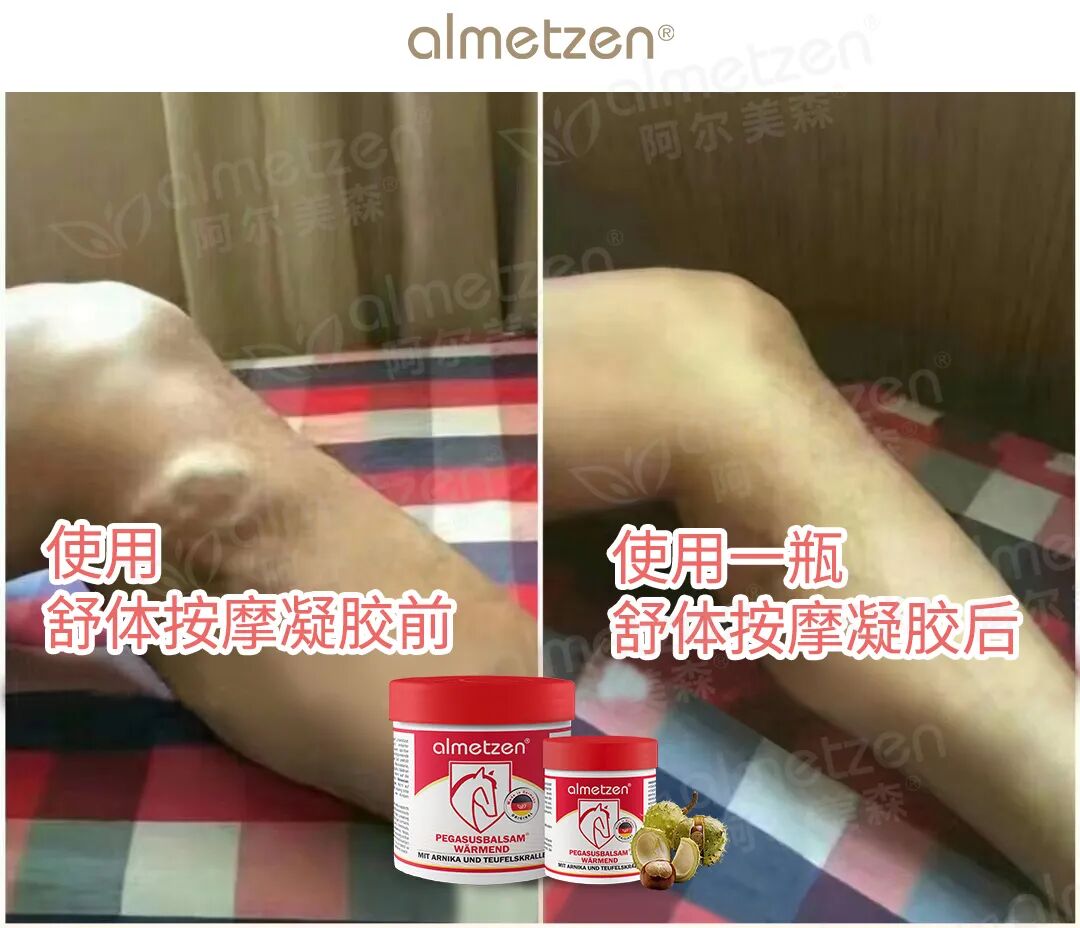 什么德国凝胶「德国阿尔美森舒体按摩凝胶」德国专业球员指定康复产品！凝胶自发热，5分钟缓解，欧盟品质安全温和_https://www.jmylbn.com_新闻资讯_第7张