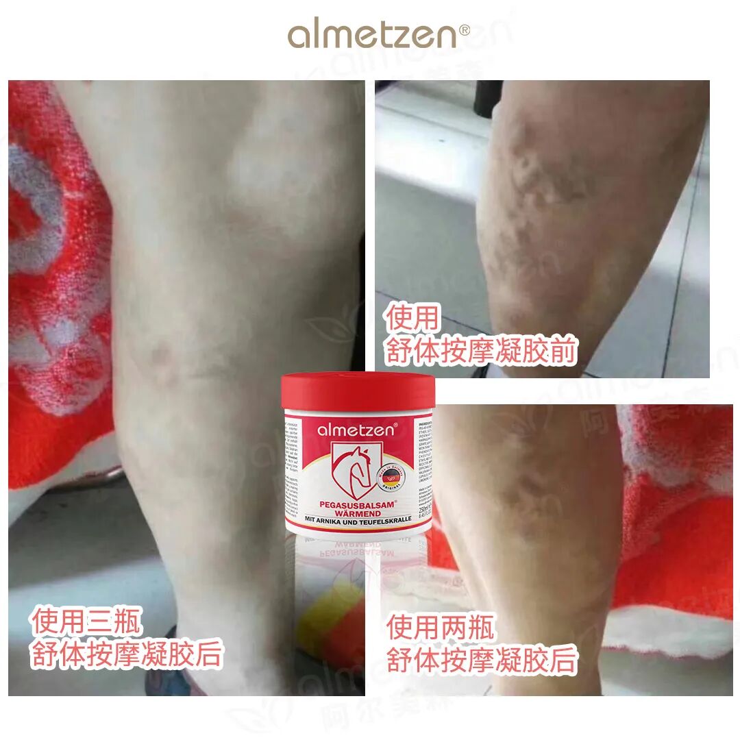 什么德国凝胶「德国阿尔美森舒体按摩凝胶」德国专业球员指定康复产品！凝胶自发热，5分钟缓解，欧盟品质安全温和_https://www.jmylbn.com_新闻资讯_第8张