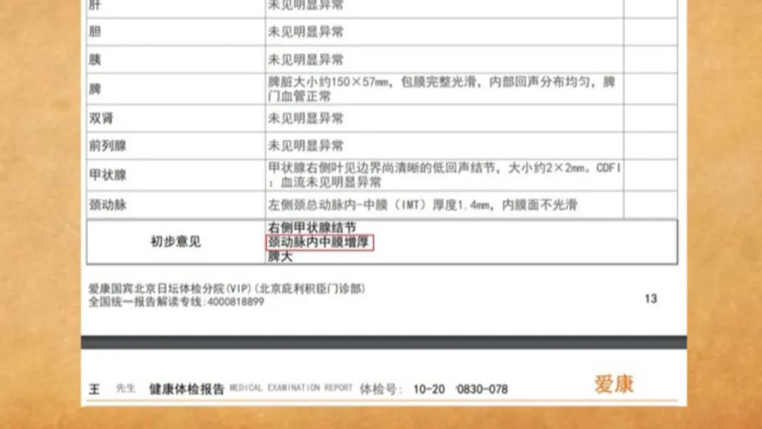 45岁，体检发现颈动脉内膜增厚，中医专家调理后显著改善