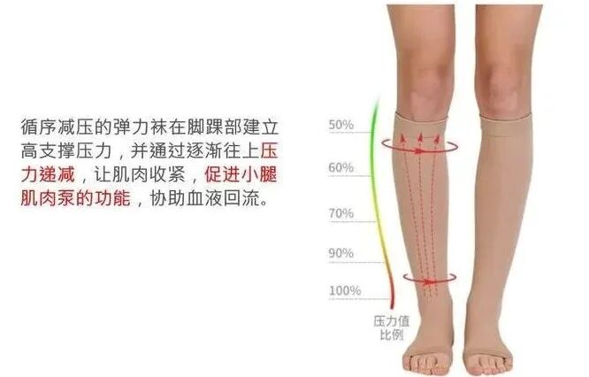 医用弹力袜用什么洗穿医用弹力袜腿痒到崩溃？3招帮您科学解决_https://www.jmylbn.com_新闻资讯_第10张
