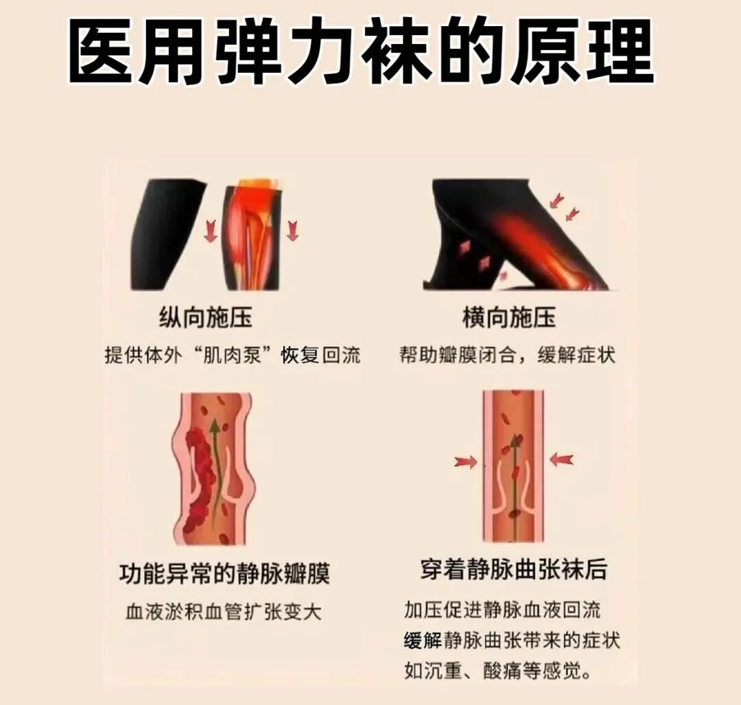 医用弹力袜用什么洗穿医用弹力袜腿痒到崩溃？3招帮您科学解决_https://www.jmylbn.com_新闻资讯_第7张