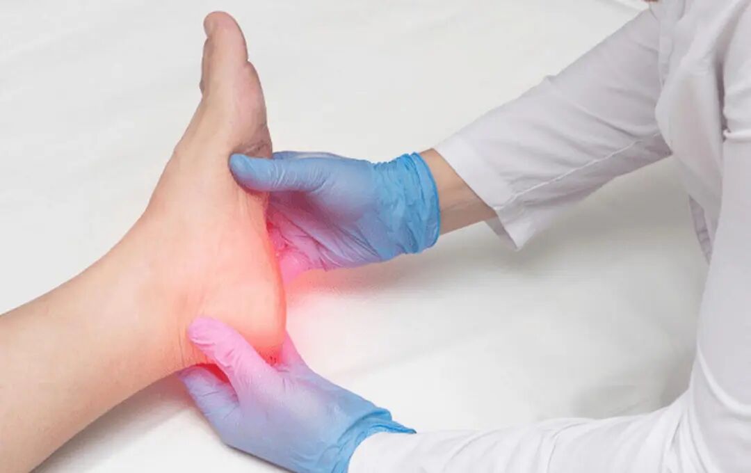 足底筋膜炎能自愈吗？筋膜炎怎么治疗？