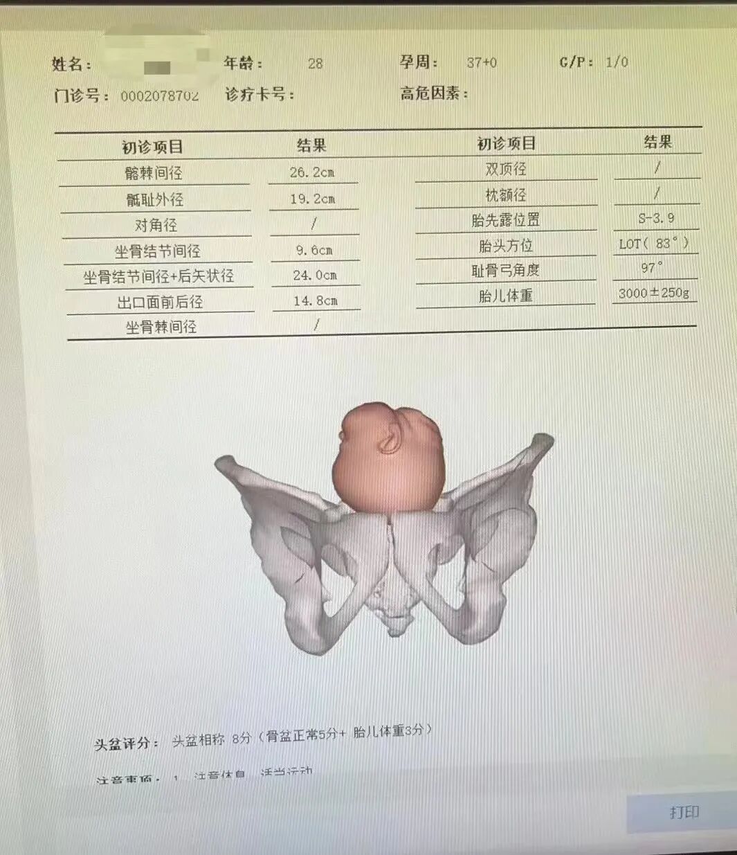 产程三维导航是什么番禺区首台三维分娩导航仪！孕妈妈顺产又添新保障_https://www.jmylbn.com_新闻资讯_第7张