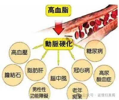 国医大师专病验方集之高脂血症