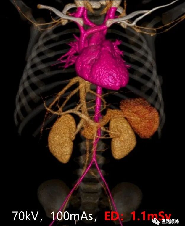 ct为什么需要预热机器Computed Tomography专栏：Incisive CT 球管预热_https://www.jmylbn.com_新闻资讯_第20张