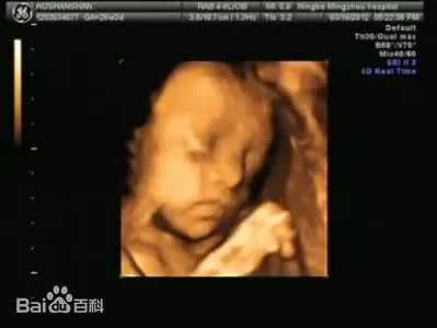 b超为什么探头发热小小的探头，大大的作用，关于B超那些事儿！_https://www.jmylbn.com_新闻资讯_第8张