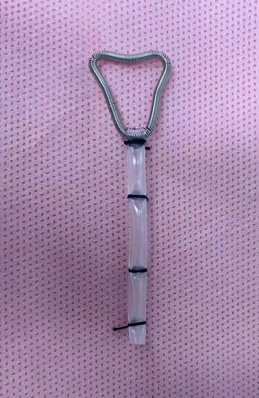 子宫支架怎么上手术新秀 ｜ 徐春焕：自制宫腔支架配合宫腔镜下冷刀分离术治疗宫腔粘连_https://www.jmylbn.com_新闻资讯_第6张