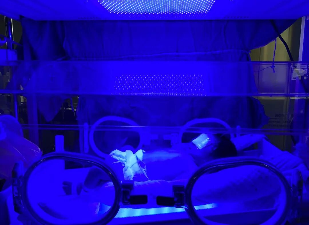 为什么要用光疗纸尿裤【便民服务】白天治疗，晚上回家！丰顺县人民医院新生儿科开展日间光疗服务啦，宝宝不用住院也能照蓝光！_https://www.jmylbn.com_新闻资讯_第10张