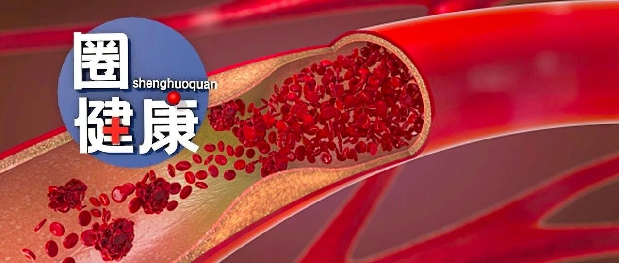 一个动作，血管可能瞬间崩溃？！推荐餐桌上5大血管“清道夫”
