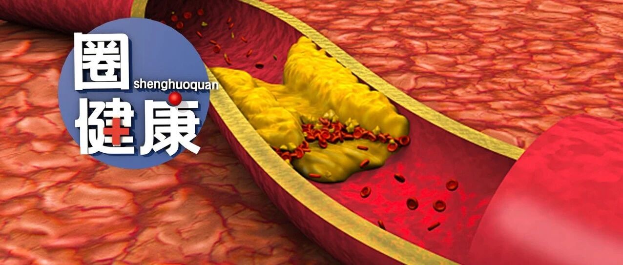 控血脂的5个误区，很多人都做错了！