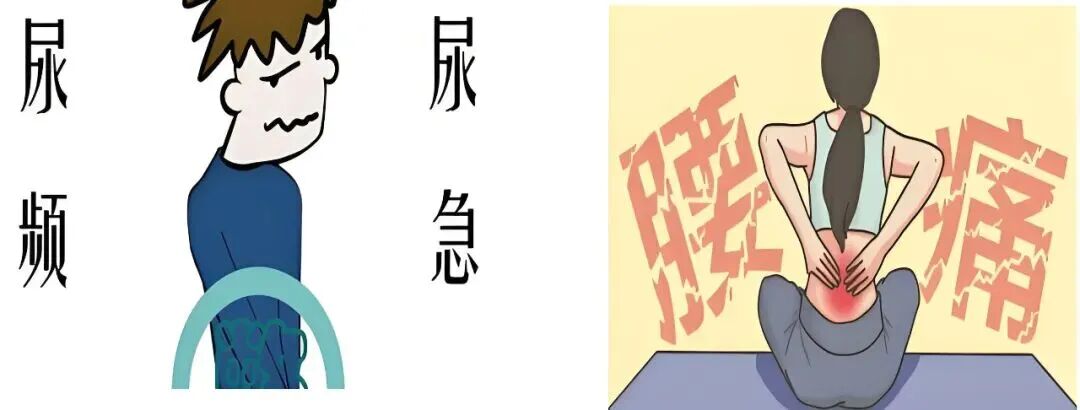 输尿管导管是什么小支架，大作用——泌尿系结石术后留置双J管患者出院指导_https://www.jmylbn.com_新闻资讯_第5张