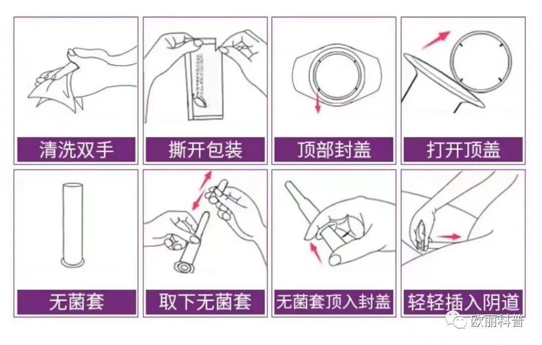 凝胶避孕怎么使用巴赫奇妙精灵液体避孕修复凝胶作用原理、使用方法_https://www.jmylbn.com_新闻资讯_第10张