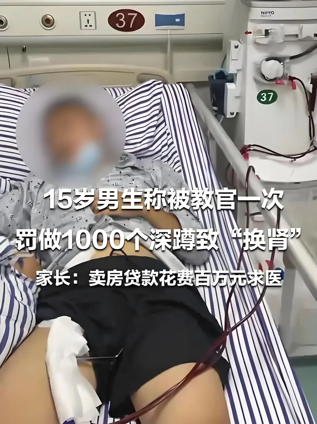 男生遭教官体罚做1000深蹲致横纹肌溶解换肾，引发公众对体罚边界的强烈关注与声讨