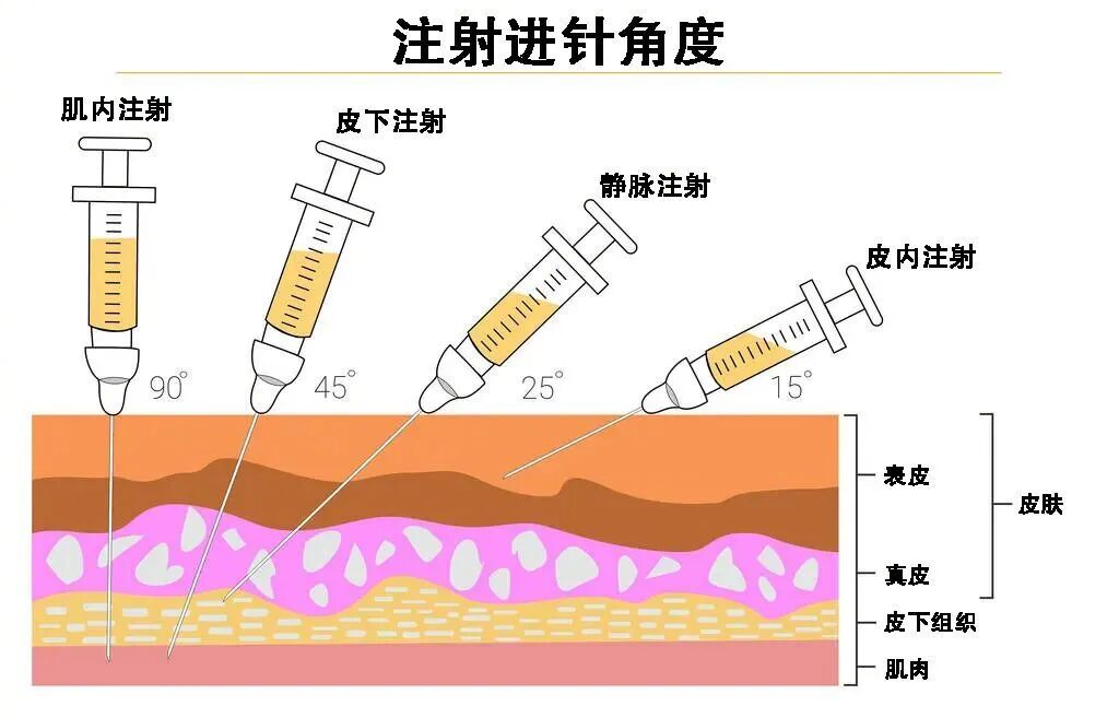 小时候的屁股针消失了为什么打针这么疼