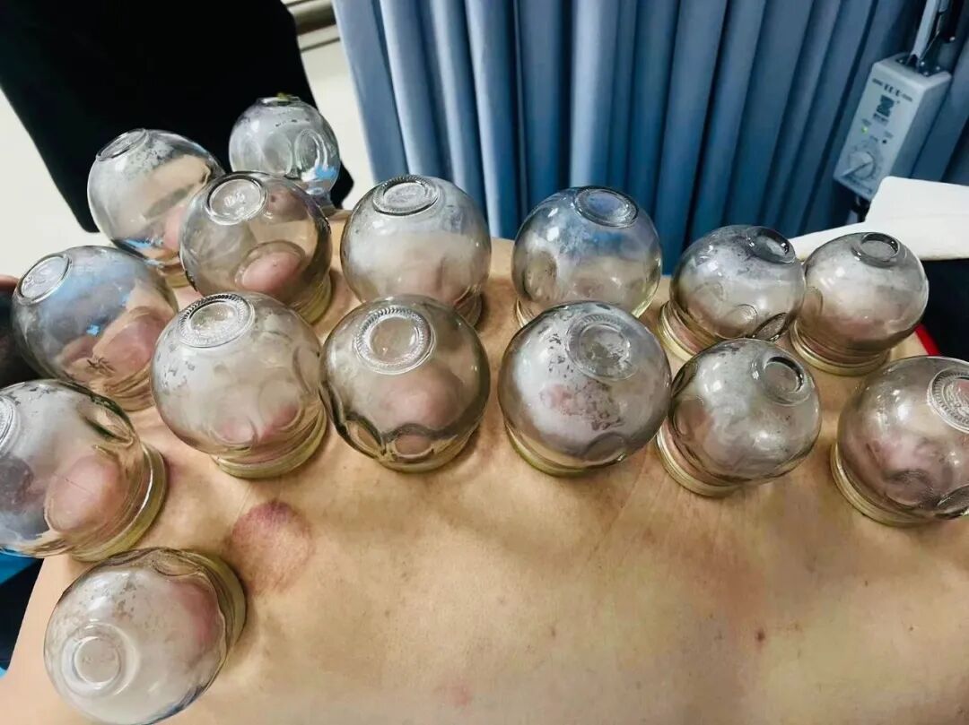 骨科理疗是什么科室简介（中医理疗科）_https://www.jmylbn.com_新闻资讯_第35张