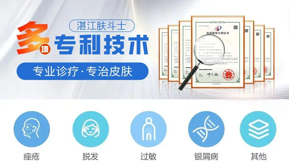 皮肤科普：足癣的发病原因和症状湛江有哪些医院治疗足癣