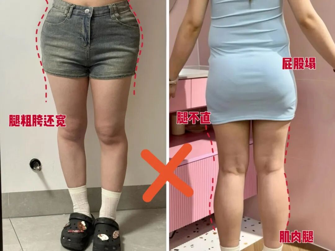 腿型缺点.jpg