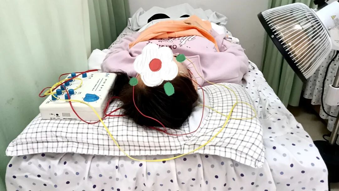 怎么买电针仪电针治疗仪：传统针灸与现代科技的融合创新_https://www.jmylbn.com_新闻资讯_第4张