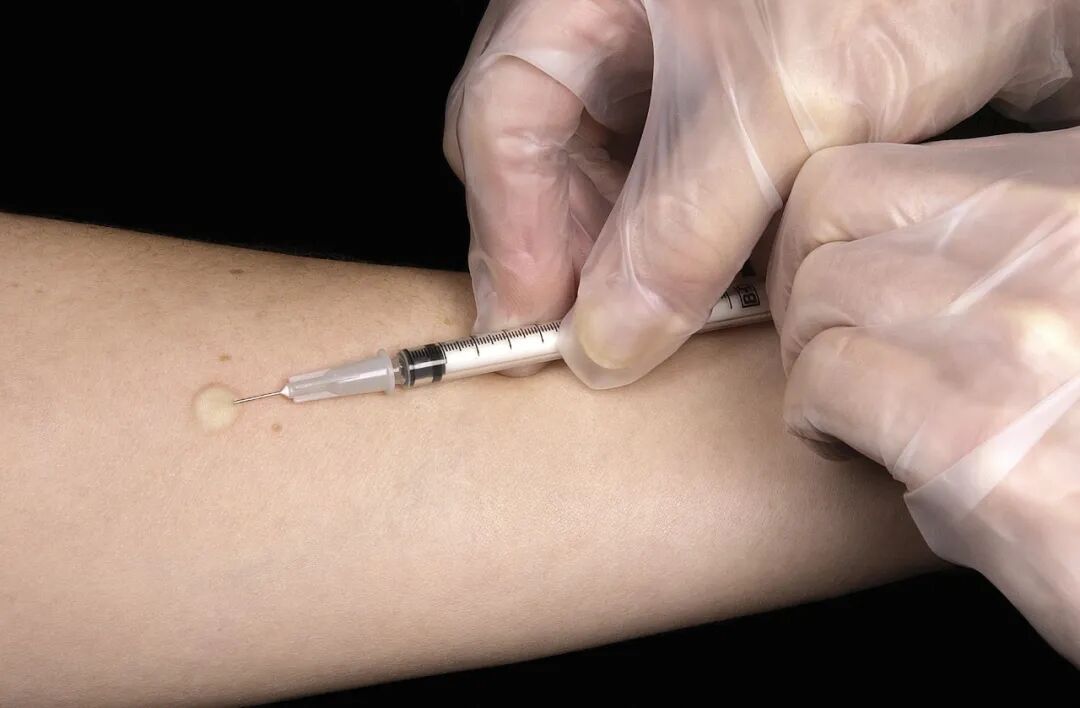 当前位置:>首页>要闻快递>正文>一般我们在做"皮试"时候用的就是这种