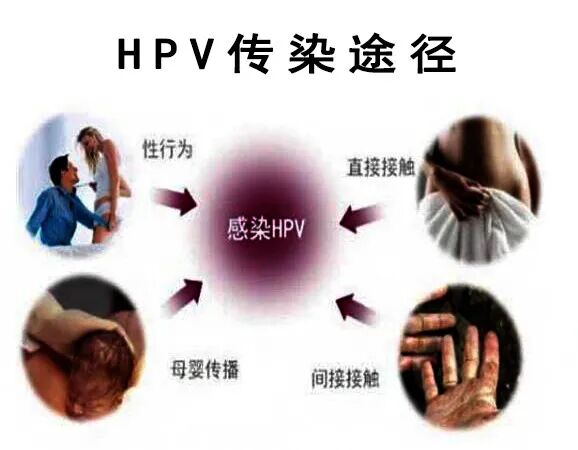 hpvdna分型分为什么型人乳头瘤病毒(hpv)基因分型检测_https://www.jmylbn.com_新闻资讯_第18张