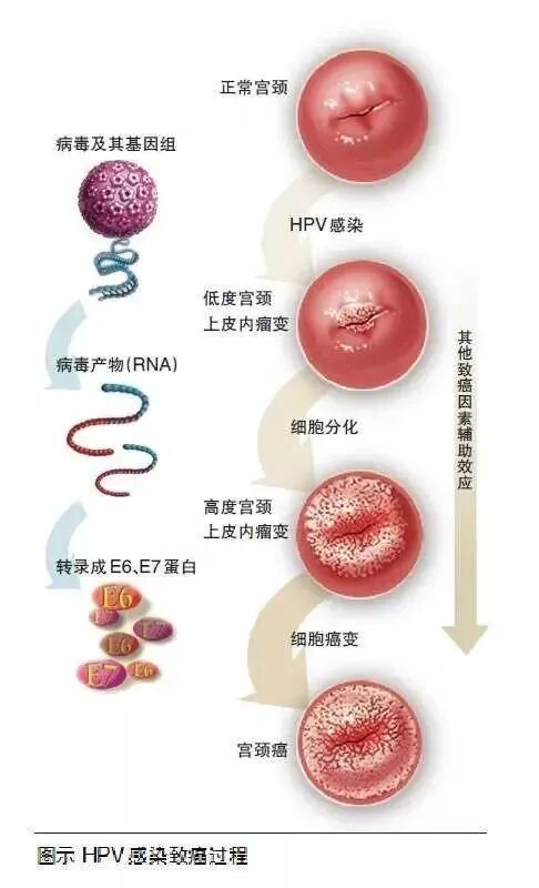 hpvdna分型分为什么型人乳头瘤病毒(hpv)基因分型检测_https://www.jmylbn.com_新闻资讯_第5张
