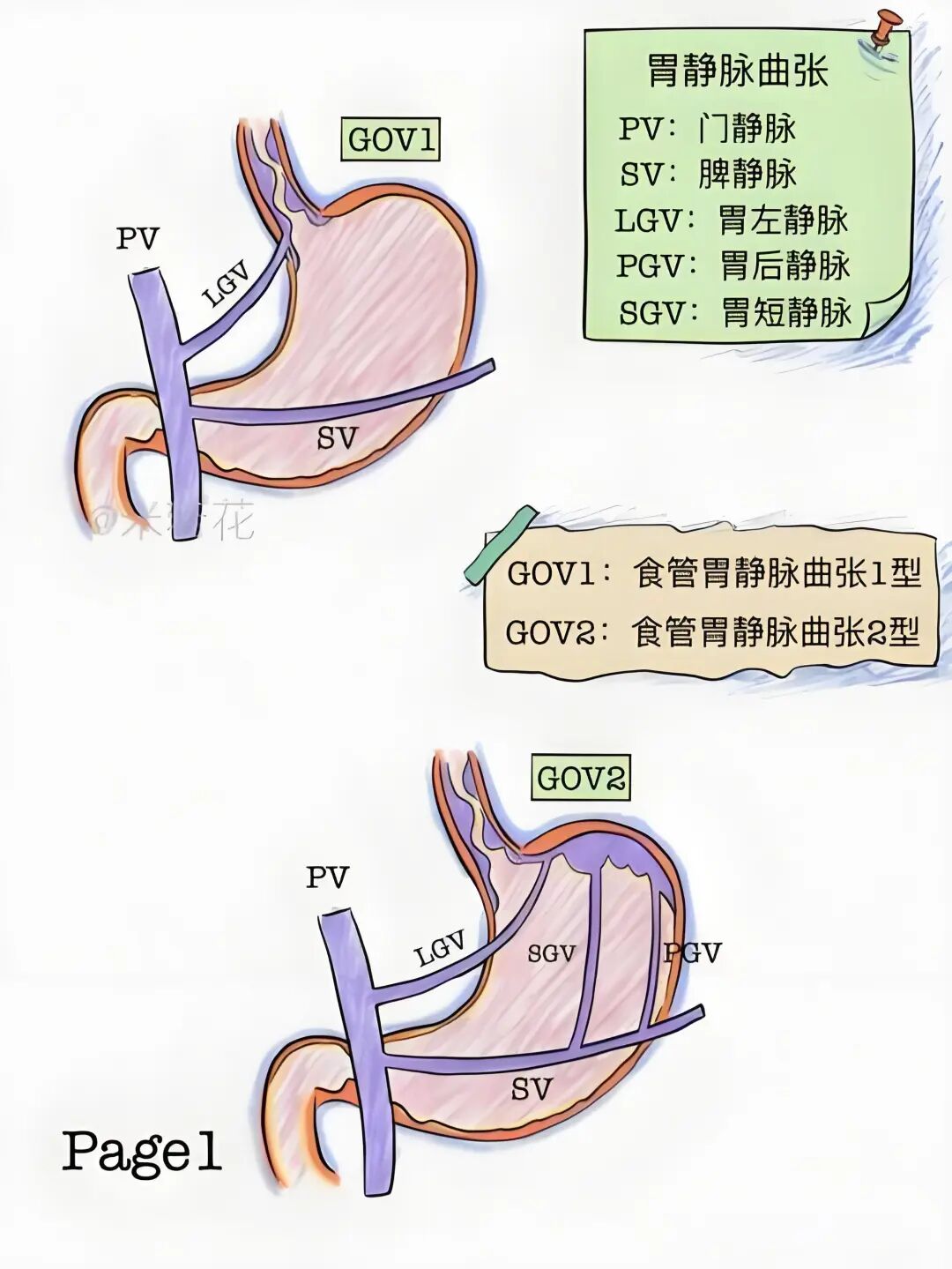 什么是显微镜手术健康科普｜显微镜下精索静脉高位结扎术_https://www.jmylbn.com_新闻资讯_第1张